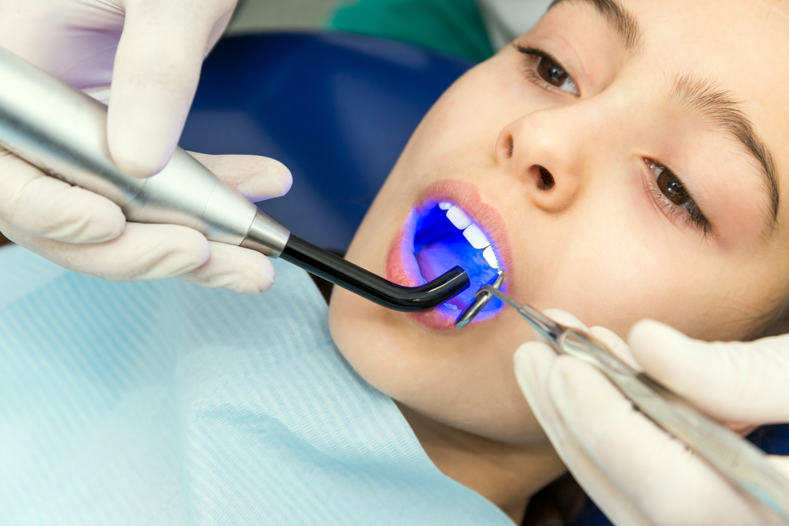 Koruyucu Diş Hekimliğinin Önemi | Minepol