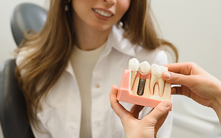 Eskişehir Dental İmplant Nedir? | Minepol